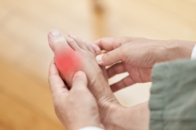Causes of and Risk Factors for Gout