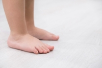 Flexible Flat Feet in Children